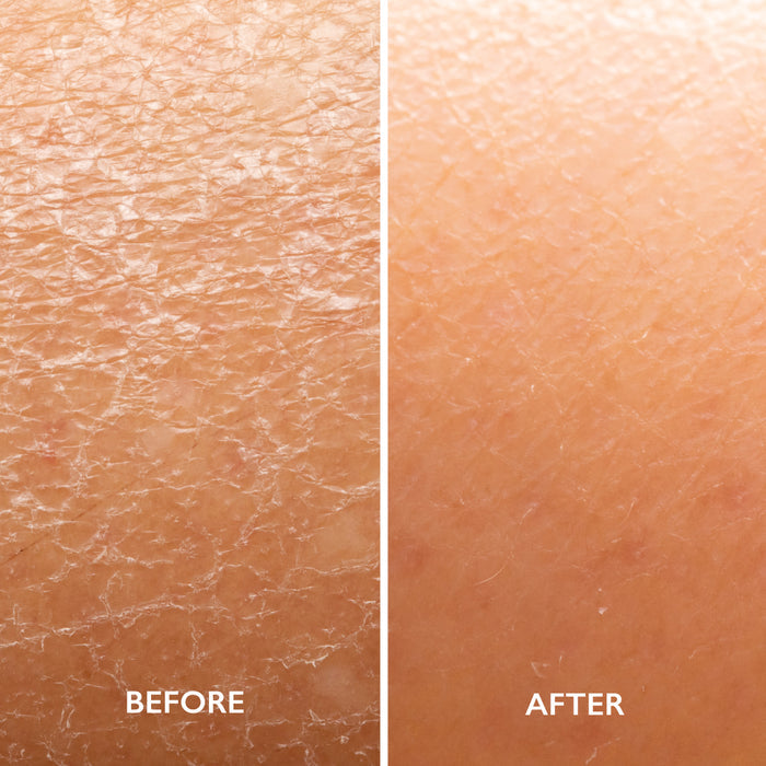 Body Lotion with AHA
