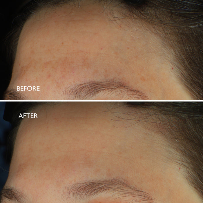 Age Benefit Hyperpigmentation Repair
