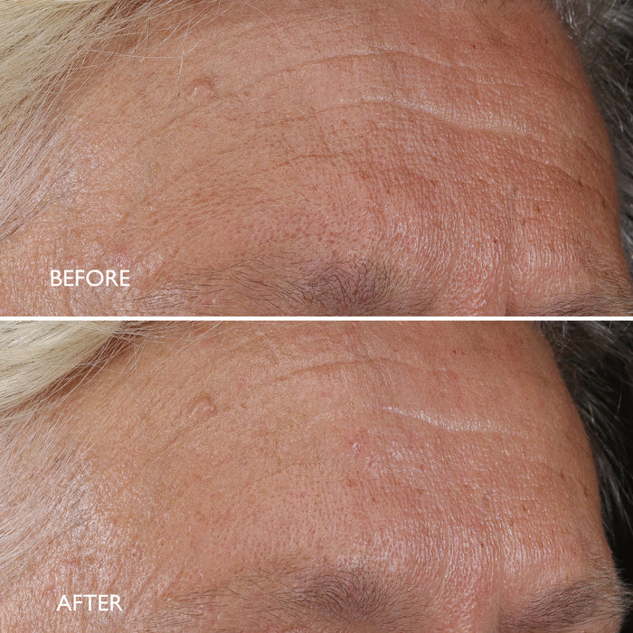 Age Benefit™ Night Renewal Cream