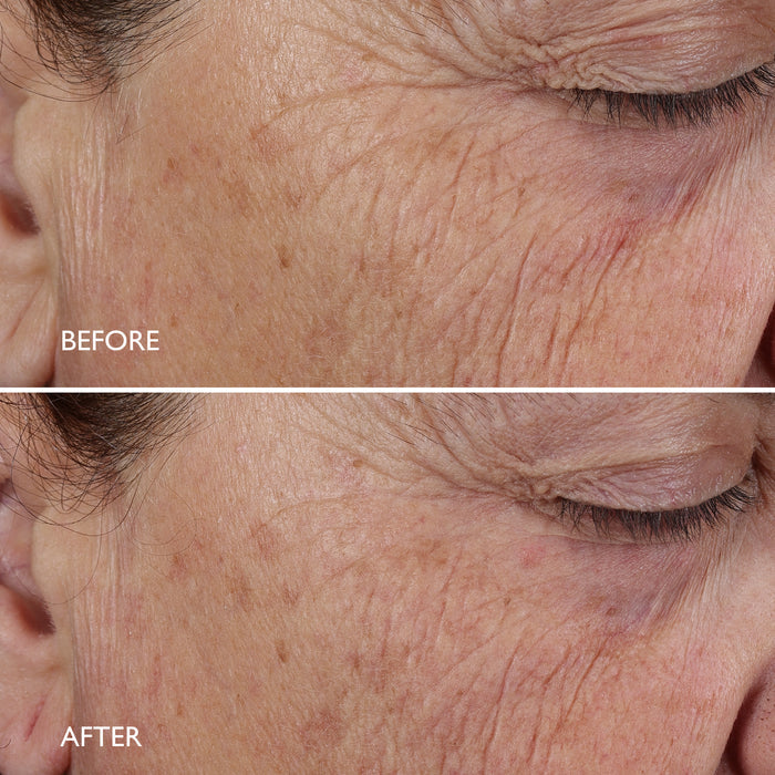 Age Benefit™ Night Renewal Cream