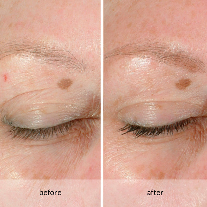 Anew Platinum Lift & Tighten Dual Eye System