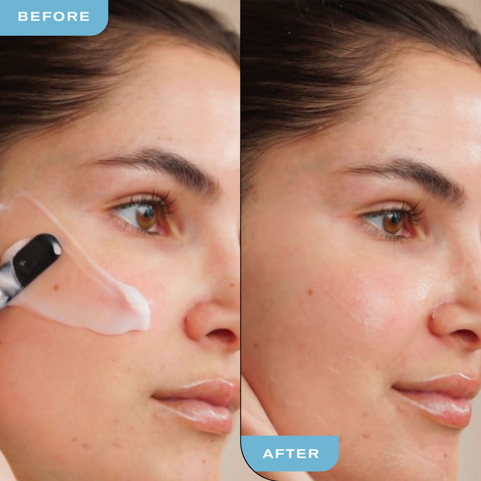 Before and After using Hydra-Therapy Memory Gel Sleep Mask