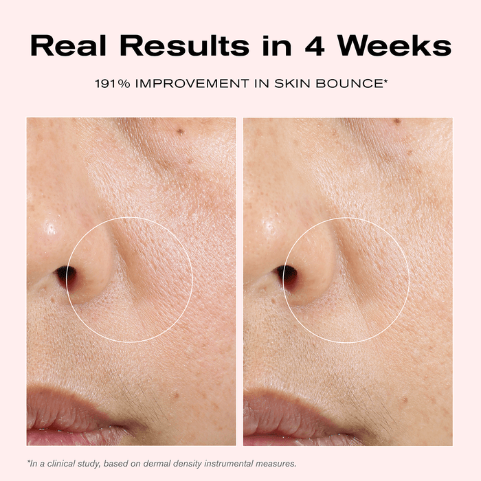 Real Results in 4 Weeks
191% Improvement in Skin Bounce*

*In a clinical study, based on dermal density instrumental measures.