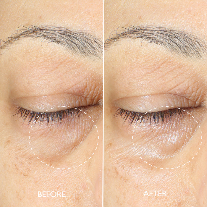 Collagene Expert™ Plump & Revive Eye Cream