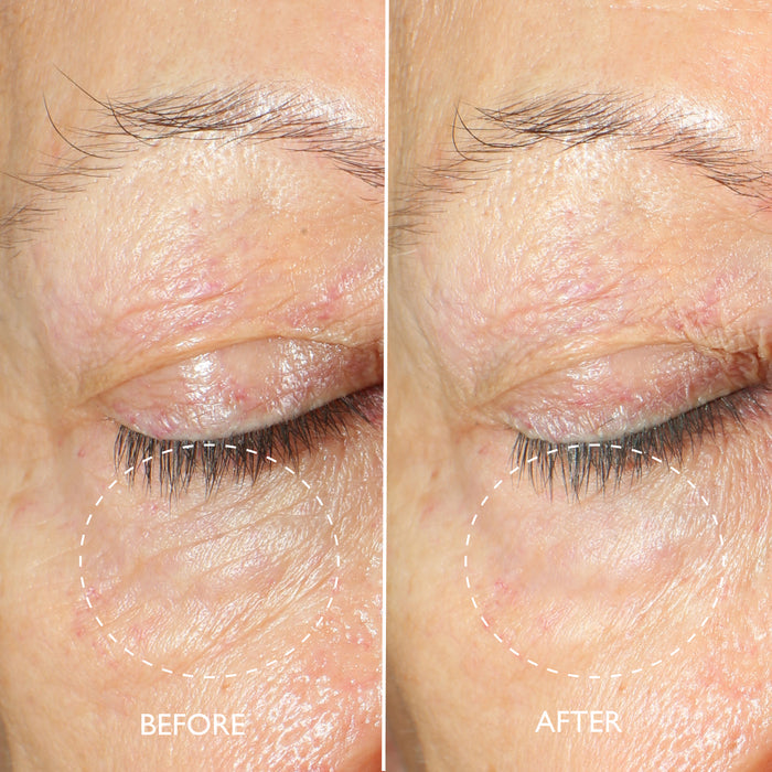 Collagene Expert™ Plump & Revive Eye Cream