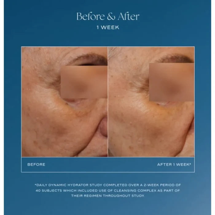 Side-by-side close-up of facial skin before and after one week using Daily Dynamic Hydrator