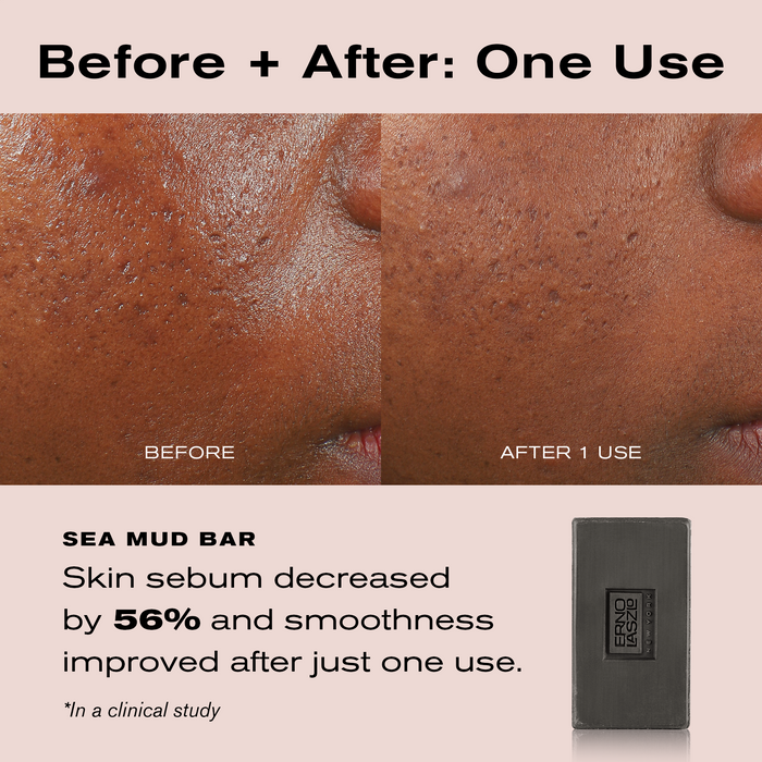 Before + After: One Use
Sea Mud Bar
Skin sebum decreased by 56% and smoothness improved after just one use. 
*In a clinical study.