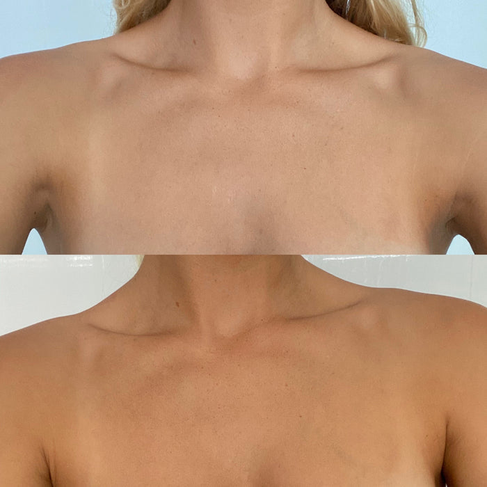 Eco Tan-Hempitan-Sun Care-Hempitan__alykingg_Before_After_Chest-The Detox Market |