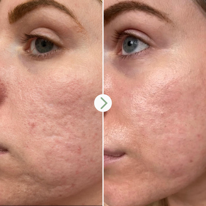 Pai Skincare-Hyaluronic Acid-Skincare-5060139729000_5-The Detox Market |
