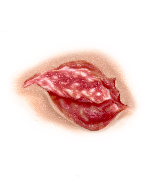Medium Body Tear