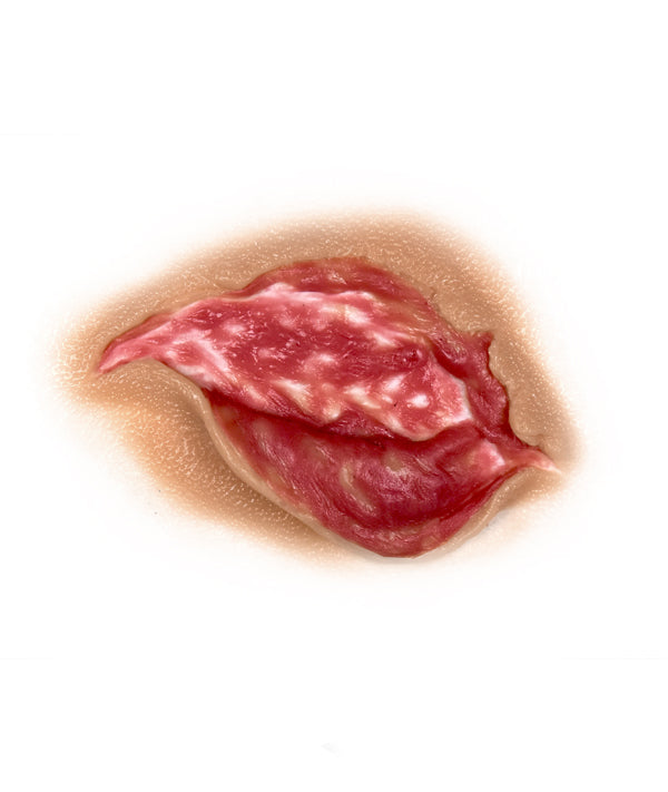 Medium Body Tear