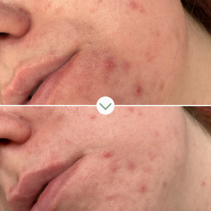 Pai Skincare-Phaze Rebalance Cleanser-Skincare-5060139729024_5_097258fa-06a8-4706-8c66-90990ee3630d-The Detox Market |