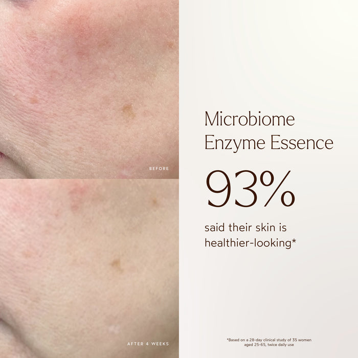True Botanicals-Renew Microbiome Enzyme Essence-Skincare-BA1_Essence_2048x2048_c666b35a-131d-419c-92ac-9ea19c0a9aa0-The Detox Market |
