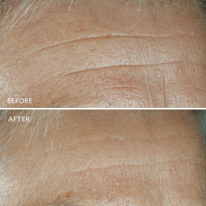 Defi Lift Active Firming Serum