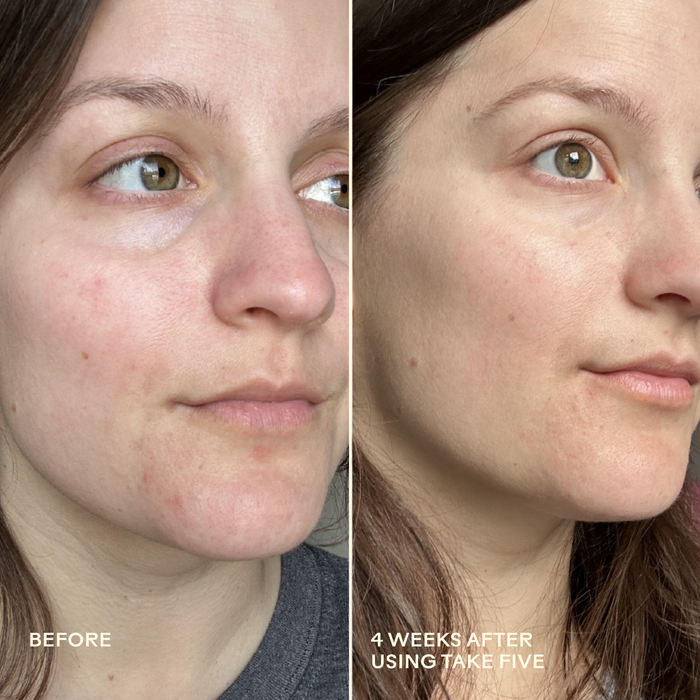Three Ships-Take Five™ Hypochlorous Acid Balancing Body + Face Spray-Skincare-990478500341_9_Before_After-The Detox Market |