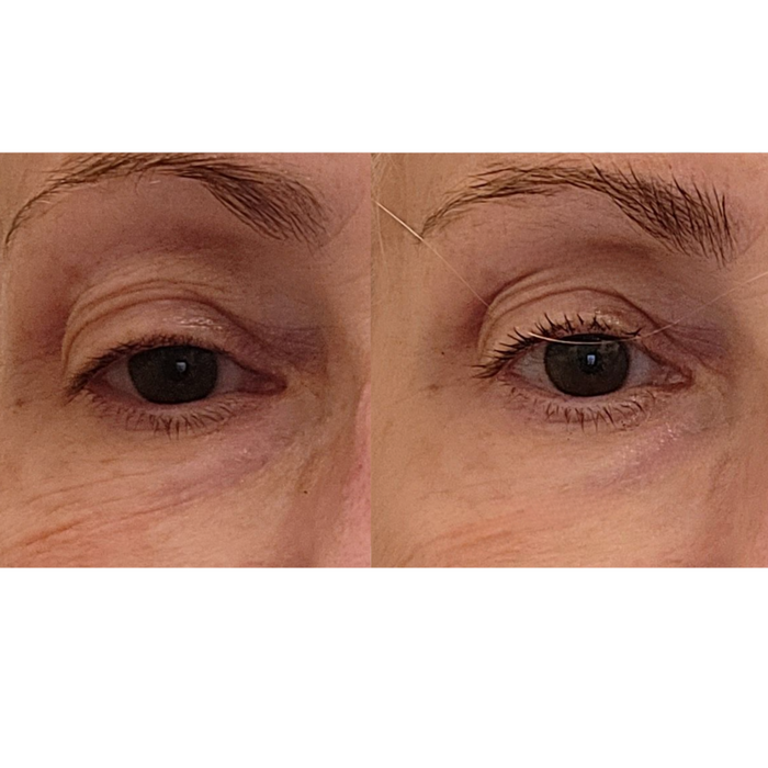 Maya Chia-The Advanced Eye Response Complex-