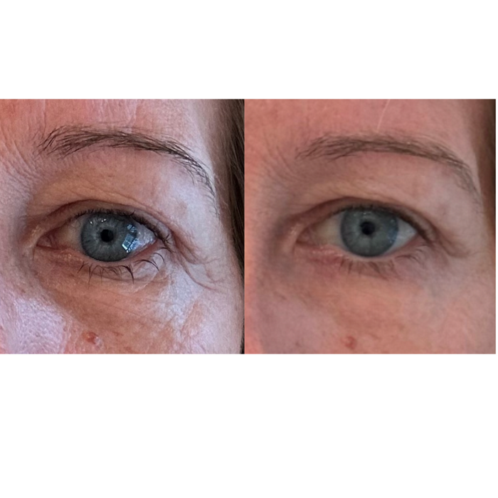 Maya Chia-The Advanced Eye Response Complex-