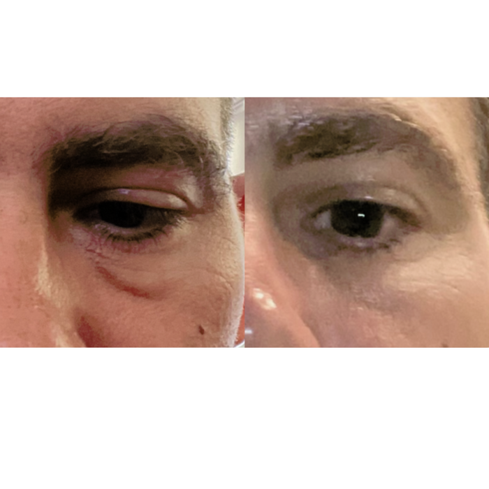 Maya Chia-The Advanced Eye Response Complex-
