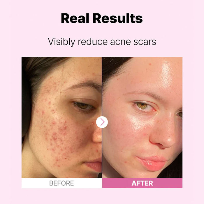 COSRX The Niacinamide 15 Serum Nudie Glow Australia