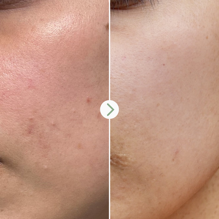 Pai Skincare-Tri-Mushroom 10-Skincare-5060139729017_5-The Detox Market |