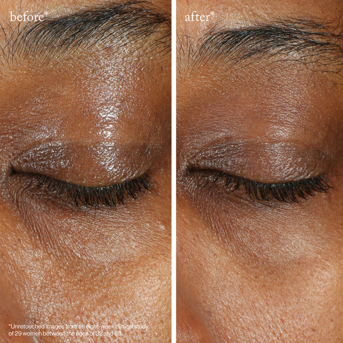 Goop-Vita-C Brightening Eye Cream-Skincare-vitaceyecream_imgCarousel_beforeandafter-The Detox Market |